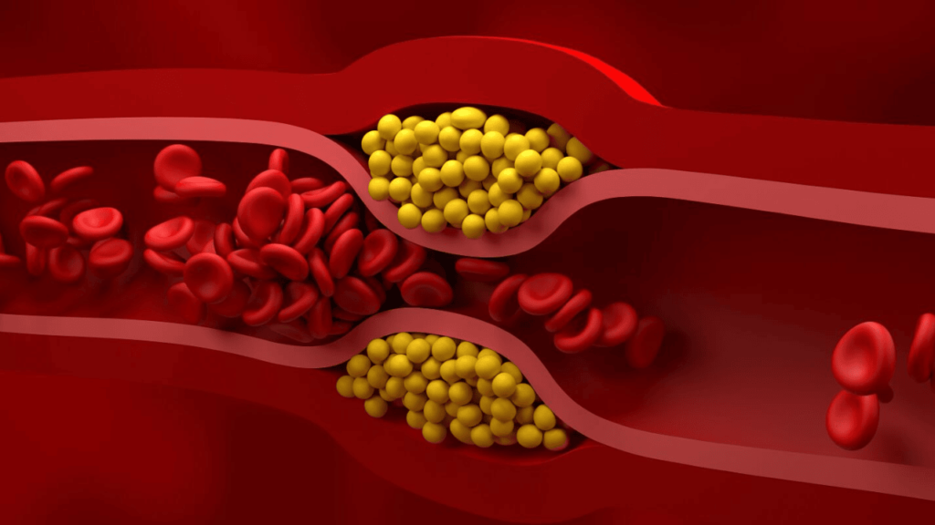 Cholesterol